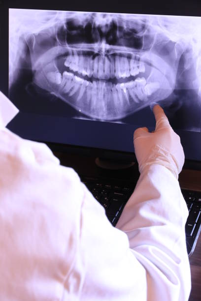 Best Urgent Tooth Repair  in San Marino, CA